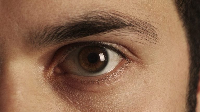 Ojos