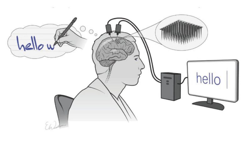 Implante Cerebral convierte los pensamientos en palabras casi en tiempo real • Tecnología • Forbes México