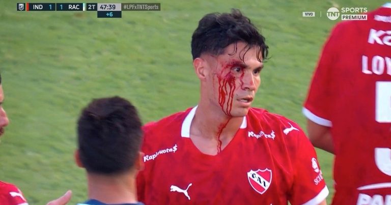 Video: ¿era roja para Maravilla Martínez por el golpe a Galdames?