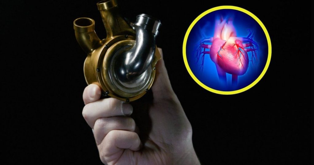 implantan un corazón de titanio y el paciente sobrevive 100 días antes del trasplante, un avance sorprendente tras 20 años de investigación