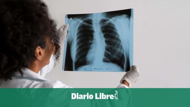 Tres virus respiratorios dominan el ambiente en RD